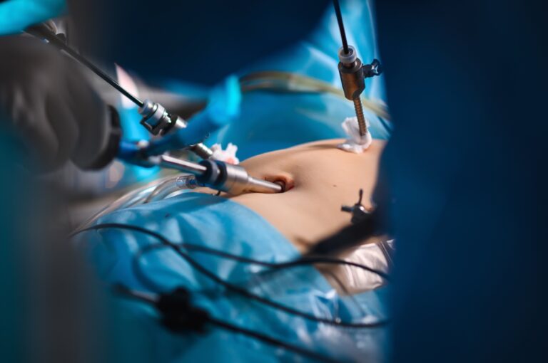 Healing Hernias with Minimally Invasive Surgery