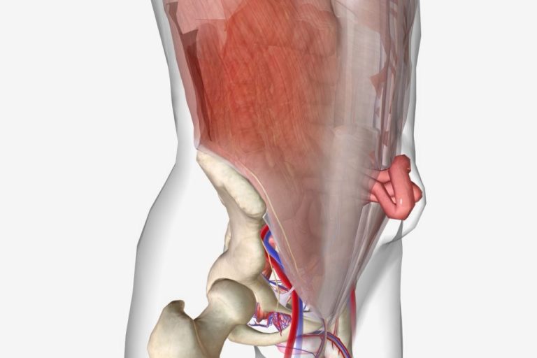 Managing Incisional Hernias After Surgery