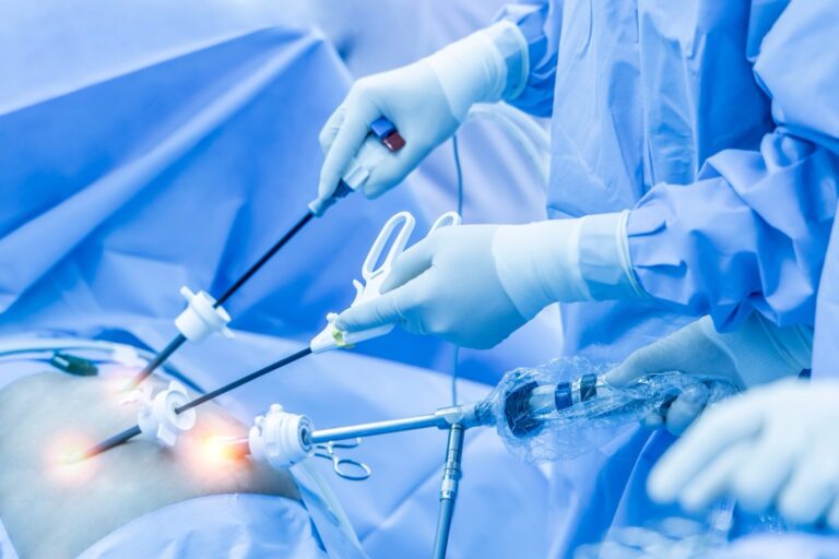 The Advantages of Laparoscopic Surgery Over Open Surgery